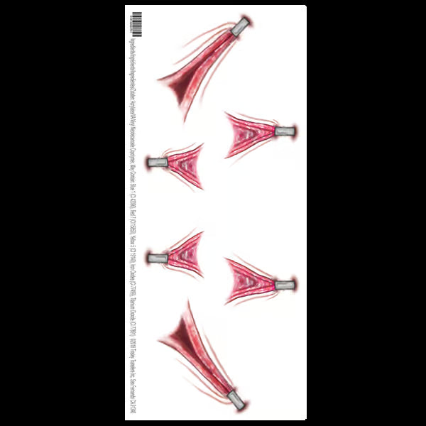 Tinsley Transfers Stretched – Trauma FX Tattoos